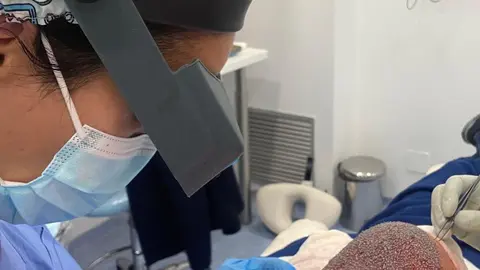 medicina capilar quiron salud