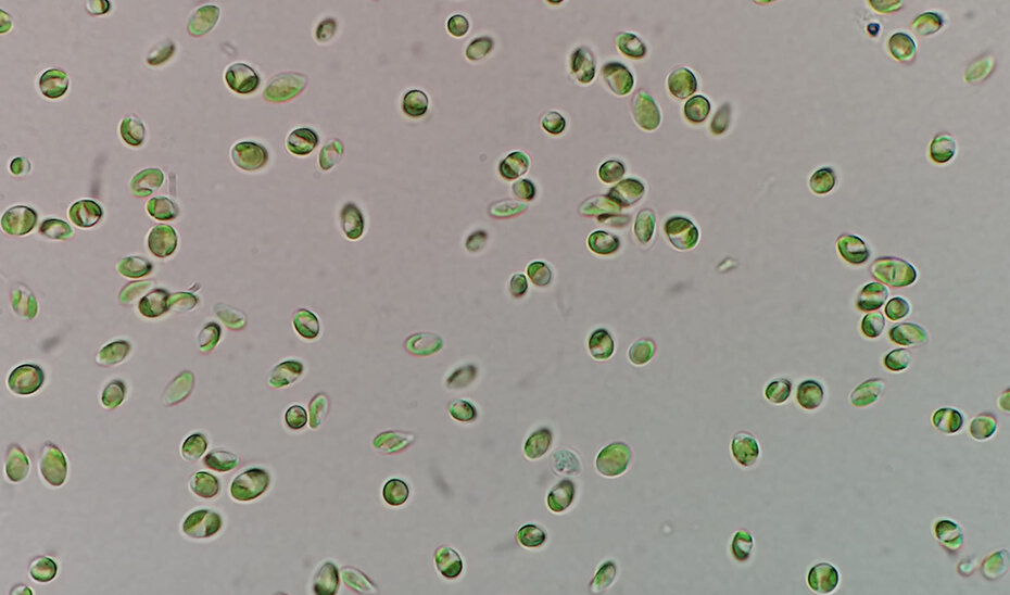 La microalga vista de un microscopio. Fuente: Junta de Andalucía